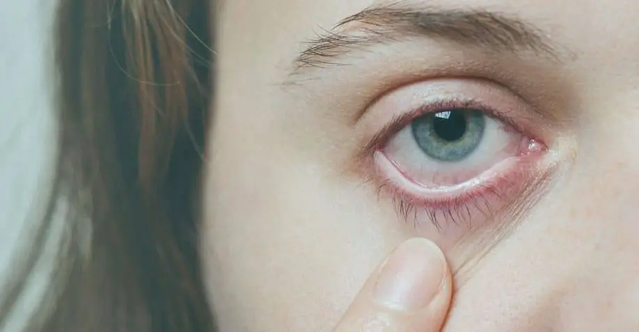 Retinal tears